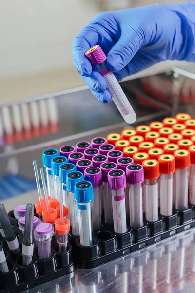 Equipamento de coleta de sangue em laboratório para análise — Fotografia de Stock