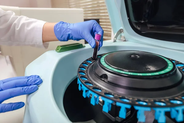 Centrifuga gép az orvosi vagy tudományos laboratóriumi minta betöltése technikus — Stock Fotó