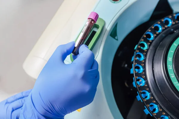 Technika ładowania próbkę do wirować w laboratorium medyczne lub naukowe — Zdjęcie stockowe
