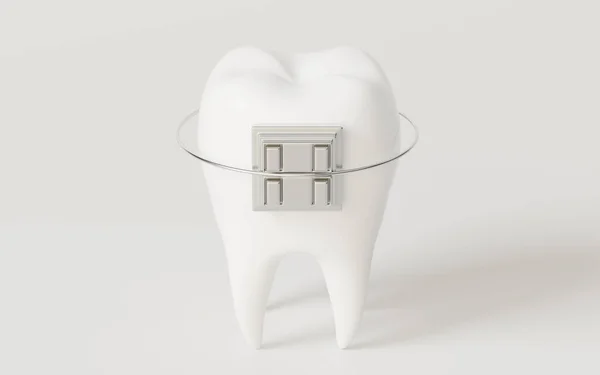 Tooth Brace White Background Rendering Computer Digital Drawing — 스톡 사진