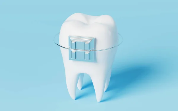 Tooth Brace Blue Background Rendering Computer Digital Drawing — 스톡 사진