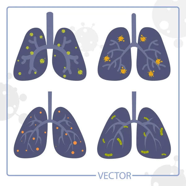 Sinais de pulmões, pneumonia, asma, cancro sob a forma de anatomia pulmonar e vírus, bactérias que causam doenças. — Vetor de Stock