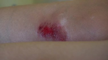 Beyaz bir kadının diz yarasına kan ve çiziklerle yakın plan.