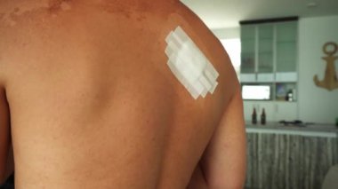 Sargı bezi ve pamukla iyileşmiş bir adamın sırtında küçük bir ameliyat.