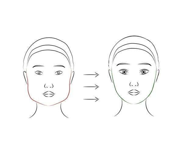 女性の顔に形成外科 Silhouette 顔のライン ベクターイラスト — ストックベクタ