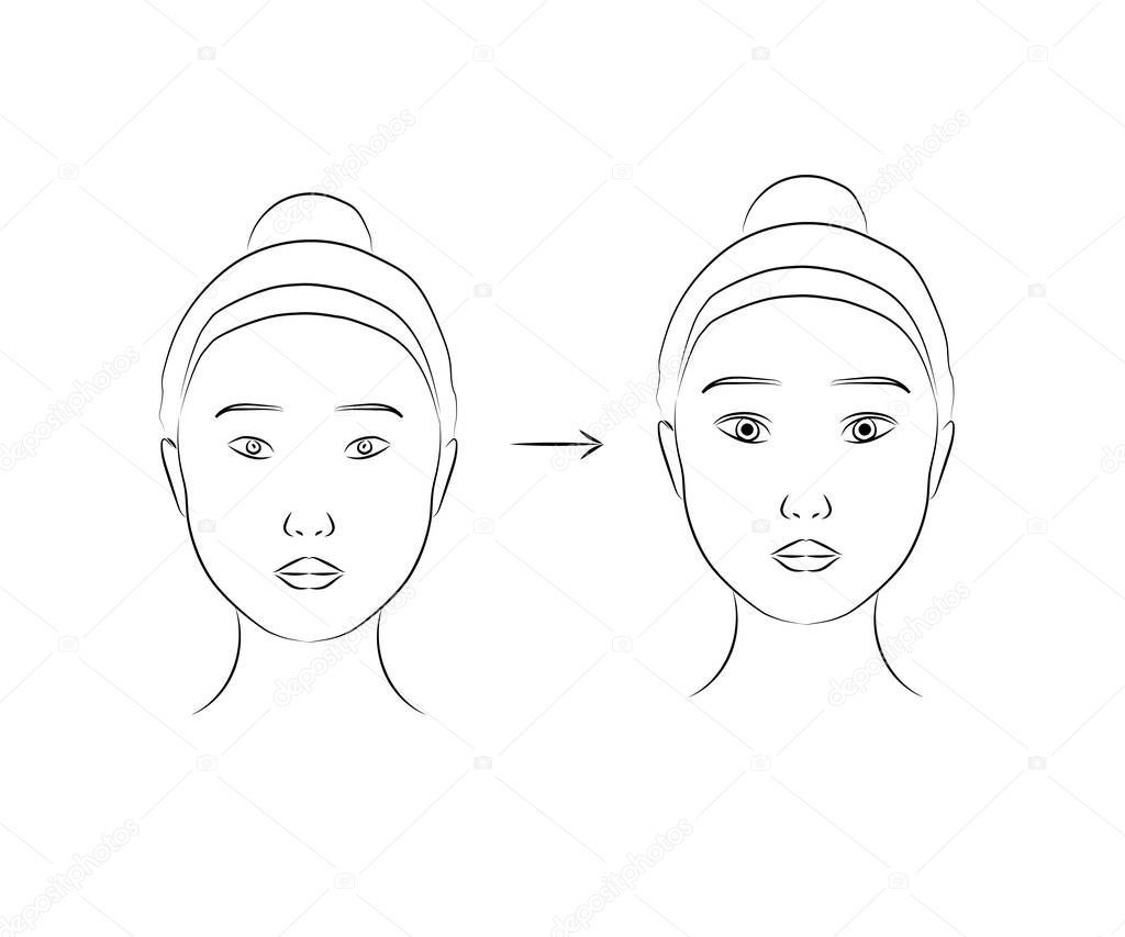 Woman face on isolated background. Plastic surgery. Vector illustration.