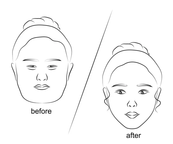 Женское Лицо Изолированном Фоне Пластическая Хирургия Векторная Иллюстрация — стоковый вектор