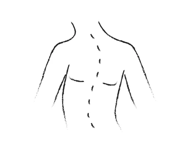 Human Curved Spine Symbol Vector Illustration — стоковый вектор
