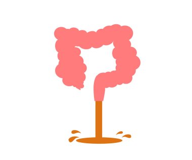 Beyaz arka planda ishal. Bağırsak rahatsızlığı. Vektör illüstrasyonu.