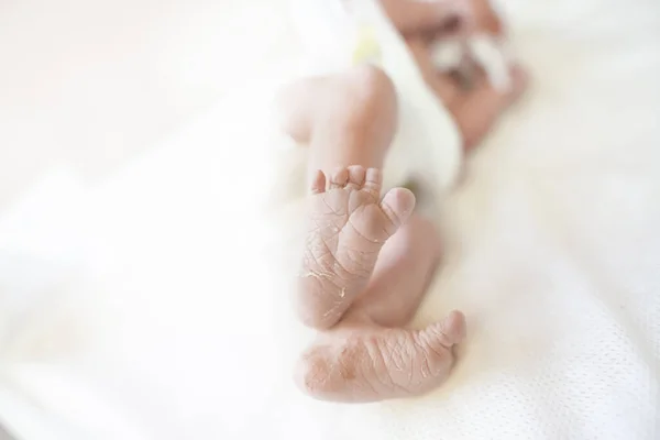 Ноги Каблуки Новорожденного Ребенка Который Лежит Инкубаторе Родильном Отделении — стоковое фото