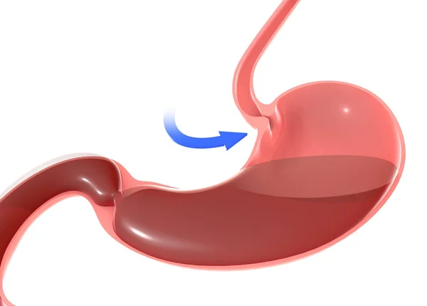 İnsan midesinde, duodenal sfinkter ve yemek borusunu vurgulayan 3 boyutlu bir çizim. Mavi bir ok ve işaret eden hareketlerle.