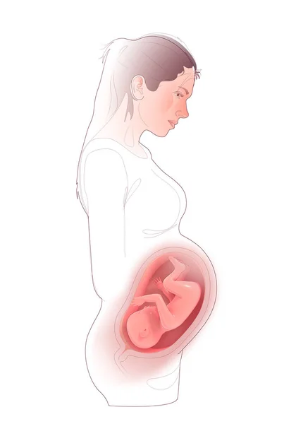 Mixed Media Line Illustration Pregnant Woman Showing Developing Human Fetus — Fotografia de Stock