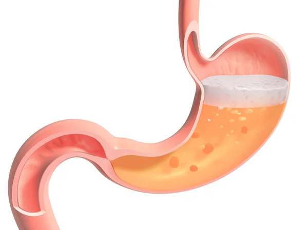 İnsan midesinin sindirim yaparken 3 boyutlu çizimi. Beyaz arkaplanda anatomik iç kesimi gösteriliyor.
