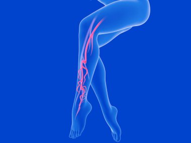 Kadın bacaklarının şeffaf anatomik 3D çizimi. Venöz sistemi varis ve arterlerle gösteriliyor..
