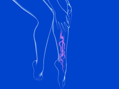 Varisli damar sisteminin 3 boyutlu çizimi. Kadın bacaklarının şeffaf cam anatomisi.