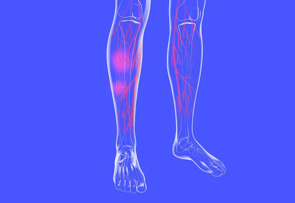 İnsan bacaklarının şeffaf anatomik 3D çizimi. Venöz sistemi varis ve egzama ile gösteriliyor..
