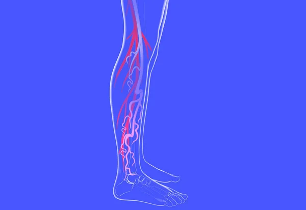 Varisli venöz sistemin 3 boyutlu çizimi. İnsan bacağının şeffaf anatomisi.