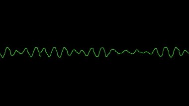 EKG kalbin ventriküler fibrilasyonunu (VF) gösterir