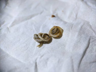Photo of roundworms coiling up after coming out with cat feces