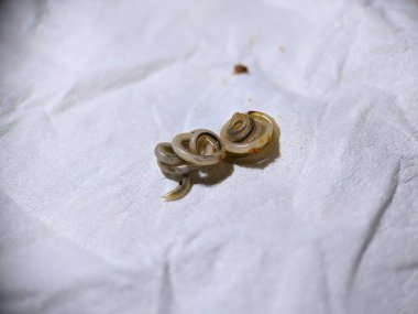 Photo of roundworms coiling up after coming out with cat feces