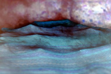 Sigara içen balıklardan duman, ön ve arka bulanıklığı