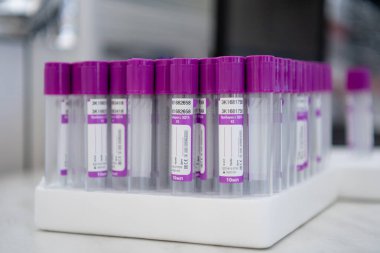 Test tüpü rafı masada