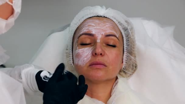 Aplikace anestetického krému na dívčí obličej před biorevitalizací, injekce krásy. — Stock video