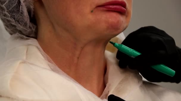 Marcando Paciente Com Marcador Antes Procedimento Injeção Beleza Facial Salão — Vídeo de Stock