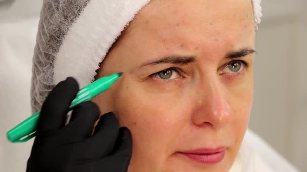 Marcando Paciente Com Marcador Antes Procedimento Injeção Beleza Facial Salão — Vídeo de Stock