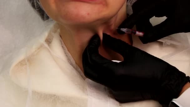 Las inyecciones de belleza se realizan inyectando en los tejidos cubiertos de arrugas del cuello. — Vídeos de Stock