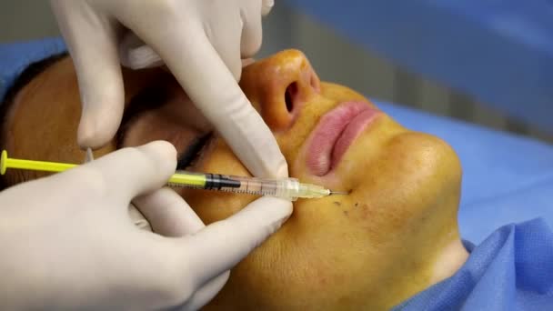 Инъекционная анестезия перед подтяжкой лица, в салоне красоты — стоковое видео