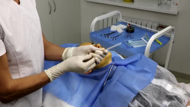 Bir güzellik salonunda, hastanın önünde yüz gerdirme ameliyatı için spiral ipliğin hazırlanması. — Stok video