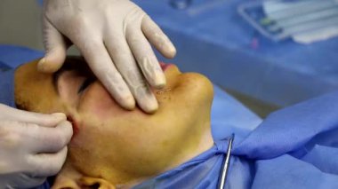 Güzellik salonundaki bir kız için sarmal ipliklerle yüz gerdirme