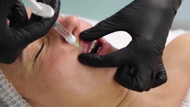 Upper lip augmentation and volume with fillers in a beauty salon — Vídeo de Stock