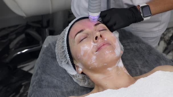 Омолодження шкіри електричними радіохвилями в лобі дорослої жінки в косметичному салоні краси — стокове відео