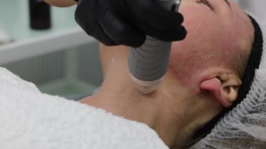 Boyun bölgesindeki radyo dalgalarının yardımıyla cilt tazeleme.