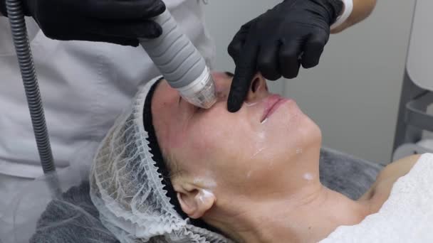 Föryngring av huden på en kvinna ansikte med hjälp av en elektrisk radiovåg — Stockvideo