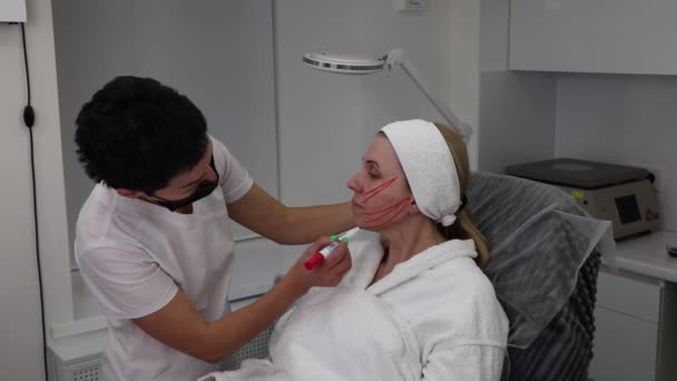 Drawing Lines Patients Face Marker Facelift Procedure Threads Beauty Salon — Video