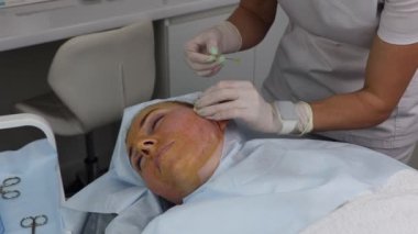 Yetişkin bir kadın için emililebilir ipliklerle yüzün kaldırılması, yakın plan..