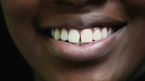 Una Chica Africana Sonrisa Macro Primer Plano Boca —  Fotos de Stock