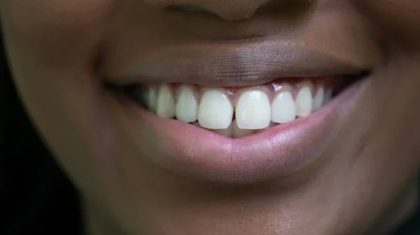 Une Jeune Femme Noire Bouche Close Macro Sourire — Photo