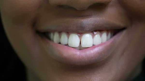 一个年轻的黑人女人嘴角挂着宏观的微笑 — 图库照片