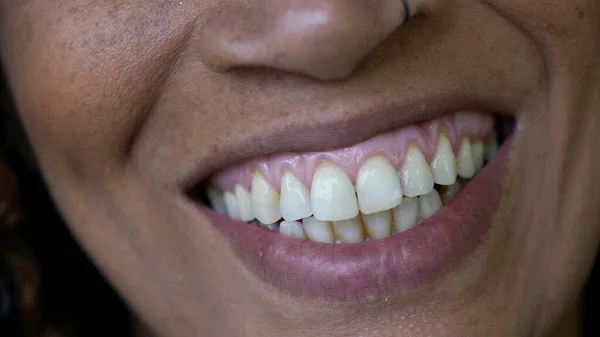 Persona Macro Primer Plano Boca Sonriendo Una Sonrisa Mujer Negra —  Fotos de Stock