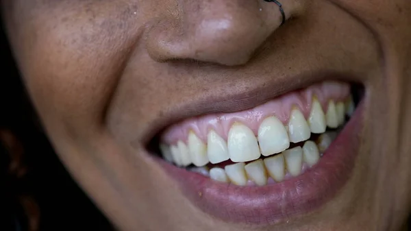 Happy Person Emotion Smiling Macro Close Mouth — Fotografia de Stock