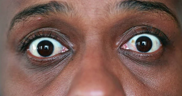 Shocked African man close-up eyes looking in HORROR