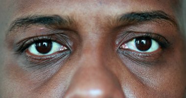 Siyah Afrikalı gözlerini kapatıyor.