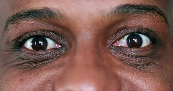 Extreme Face Close Macro Eyes Black African Man Looking Sideways — Stock Photo, Image