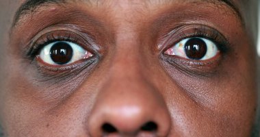 Afrikalı adam şok reaksiyonu. Makro kişi yüz ifadesi şaşırtıcıdır