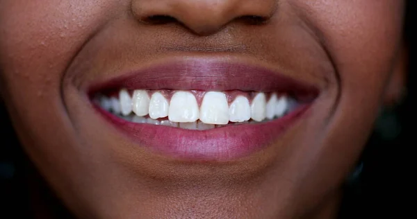 Black Girl Mouth Smiling Macro Close White Teeth African Ethnicity — Fotografia de Stock