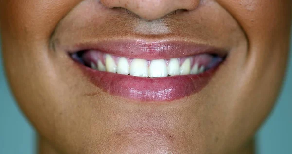 Black Woman Changing Mood Close Mouth Changes Emotion — Stockfoto